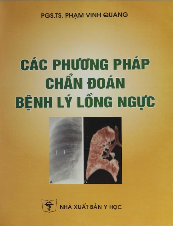 Các phương pháp chẩn đoán bệnh lý lồng ngực