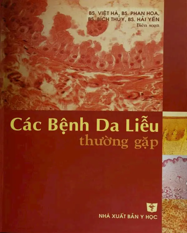 Các bệnh da liễu thường gặp