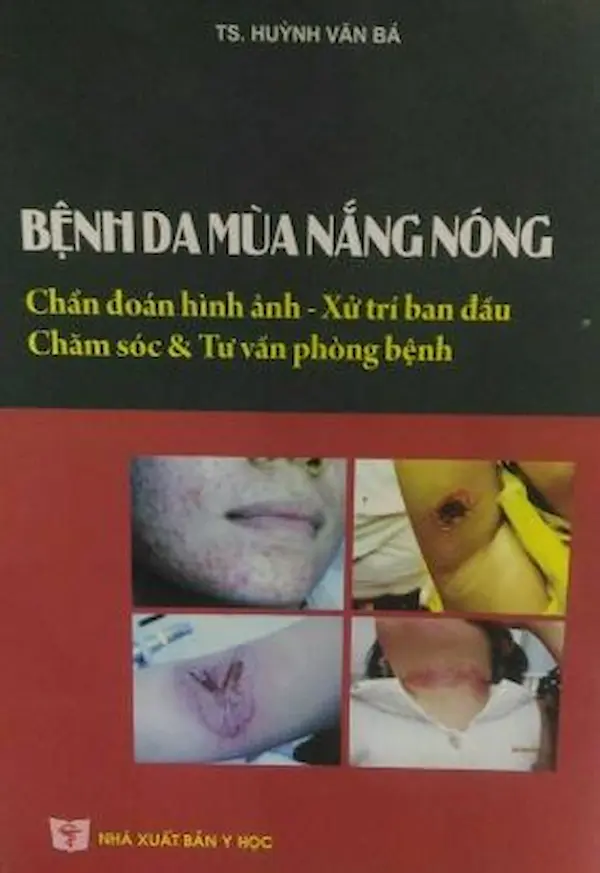 Bệnh Da Mùa Nắng Nóng