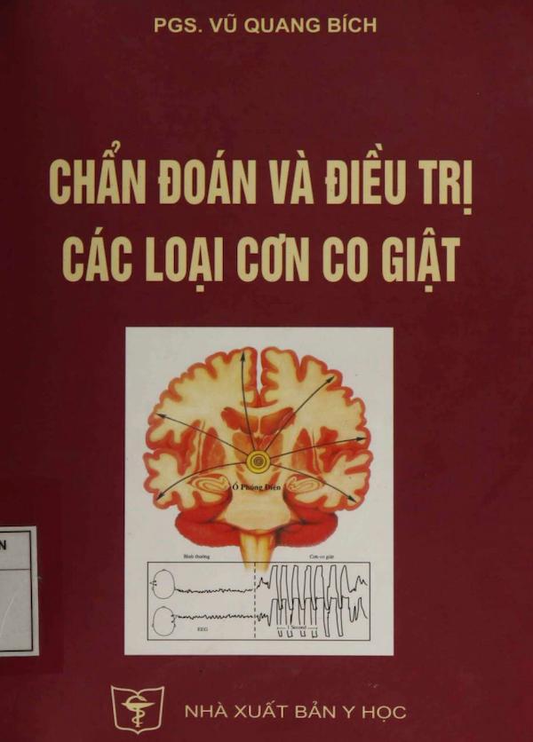 Chẩn Đoán Và Điều Trị Các Loại Cơn Co Giật