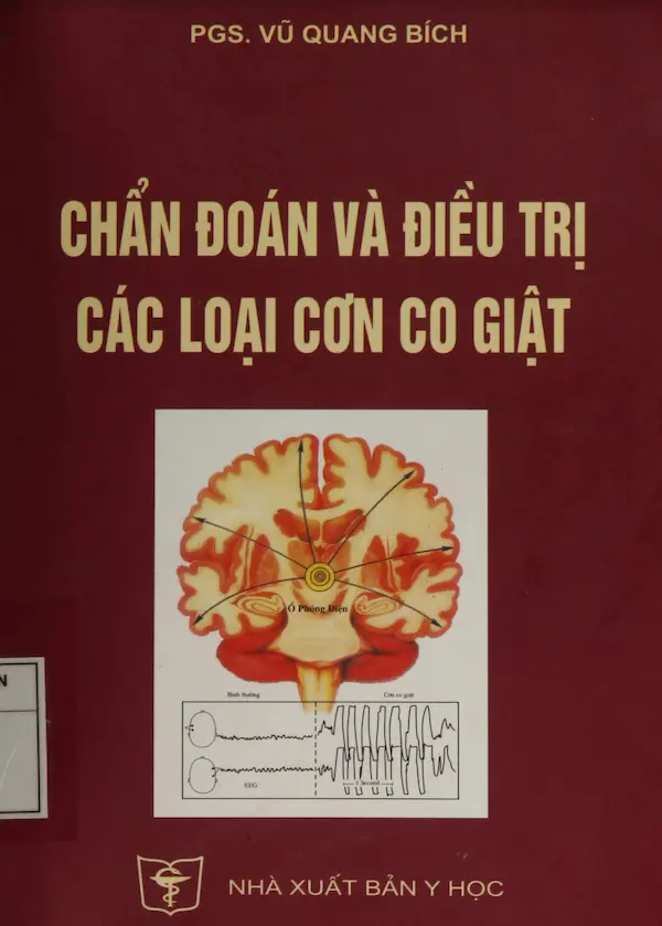 Chuẩn đoán và điều trị các loại cơn co giật